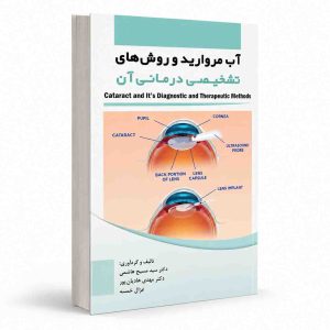 آب مروارید و روش‌های تشخیصی درمانی آن